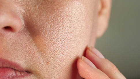 pores